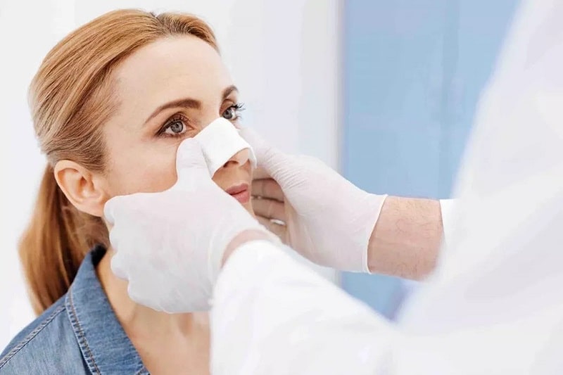 Một số kiến thức hậu phẫu nâng mũi cần biết