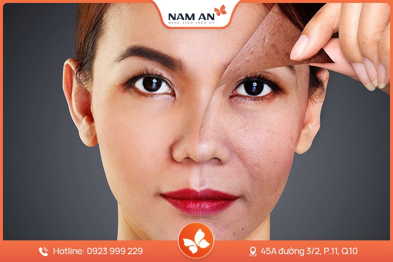 Nâng Cơ Trẻ Hóa Da HIFU Toàn Diện Tại BVTM Nam An (1)