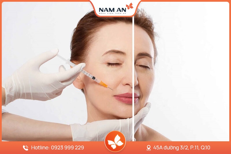 Nâng Cơ Trẻ Hóa Da HIFU Toàn Diện Tại BVTM Nam An (2)