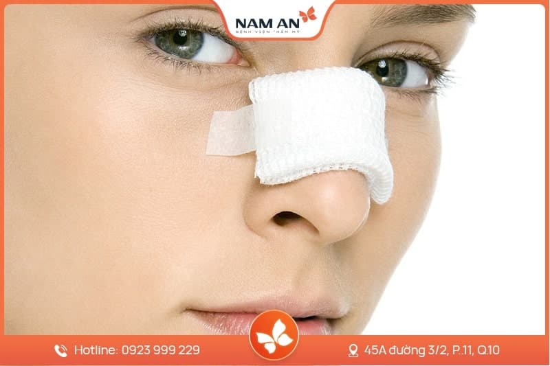 Nâng Mũi Bọc Sụn Tự Nhiên, Ngăn Biến Chứng Tại Nam An (2)