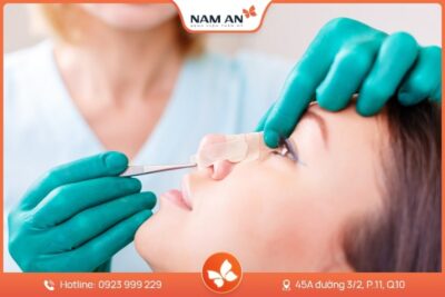 Nâng Mũi Bọc Sụn Tự Nhiên, Ngăn Biến Chứng Tại Nam An (8)