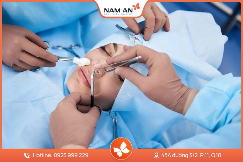 Nâng Mũi Bọc Sụn Tự Nhiên, Ngăn Biến Chứng Tại Nam An