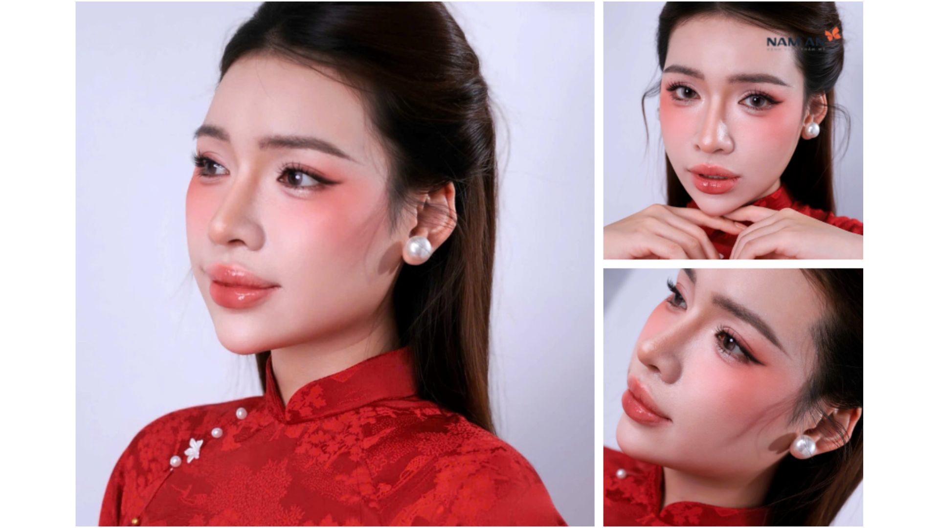 Nâng Mũi Cấu Trúc An Toàn Đón Tết Xinh Lung Linh (4)