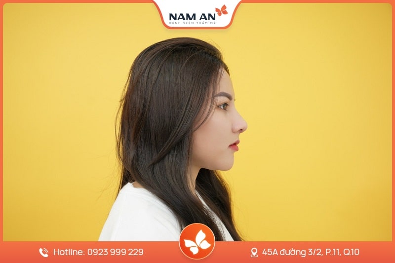 Nâng Mũi Cấu Trúc Toàn Diện (10)
