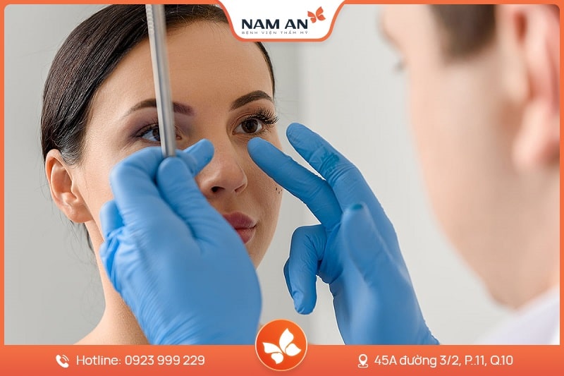 Nâng Mũi Cấu Trúc Toàn Diện (13)
