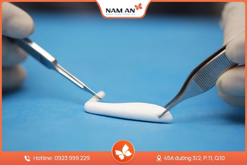 Nâng Mũi Cấu Trúc Toàn Diện (14)