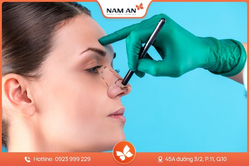 Nâng Mũi Cấu Trúc Toàn Diện (16)