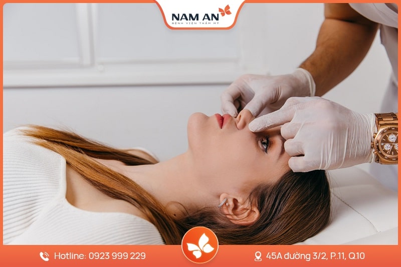 Nâng Mũi Cấu Trúc Toàn Diện (4)