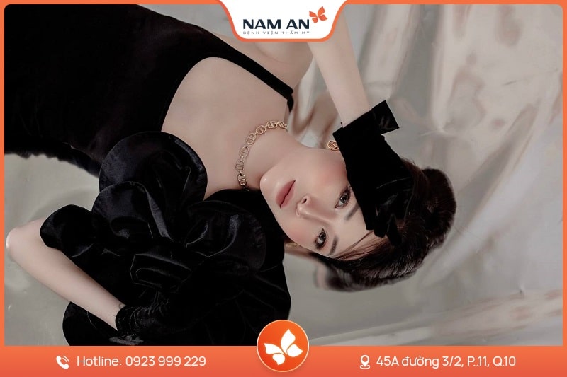 Nâng Mũi Cấu Trúc Toàn Diện (8)