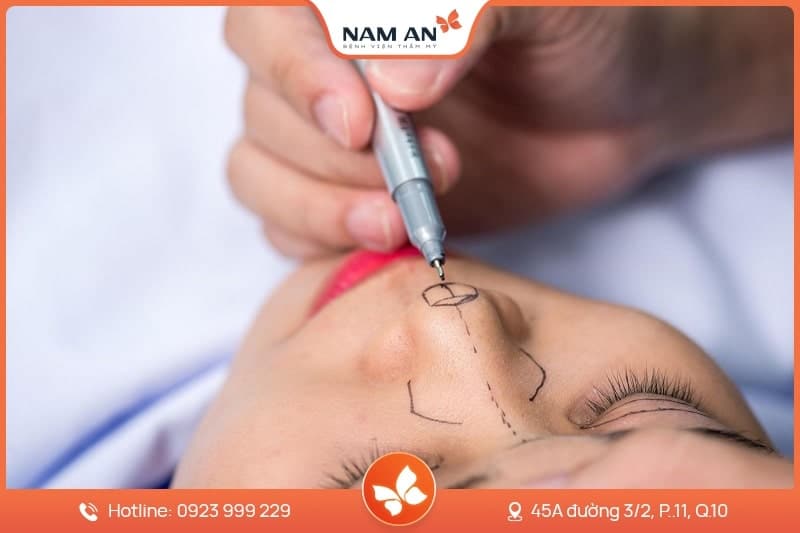 Nâng Mũi S-Line Cấu Trúc Khởi Tạo Đường Cong Mềm Mại (15)