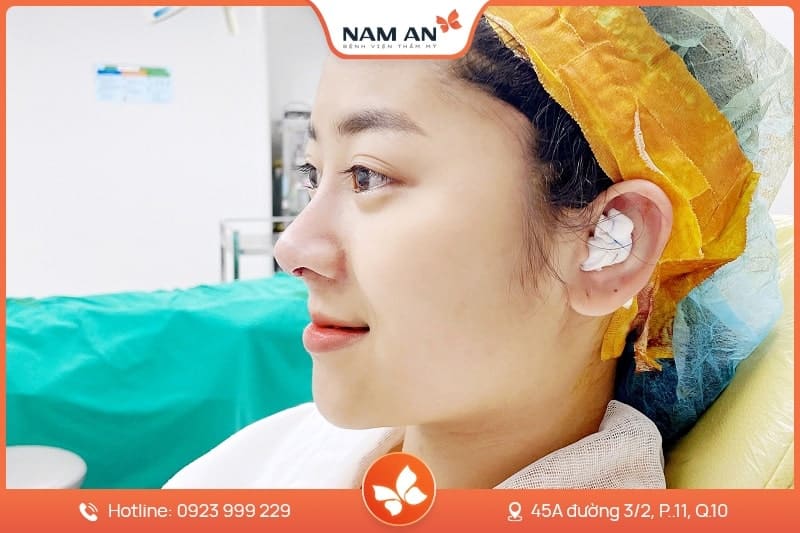 Nâng Mũi S-Line Cấu Trúc Khởi Tạo Đường Cong Mềm Mại (7)