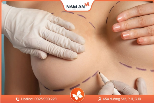 Nâng Ngực Bằng Mỡ Tự Thân Có Bền Không Giữ Được Lâu Không