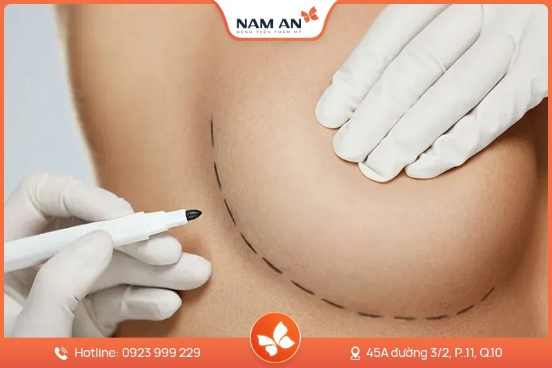 Nâng Ngực Bằng Mỡ Tự Thân Tự Nhiên Chuẩn Y Khoa Tại Nam An (4)