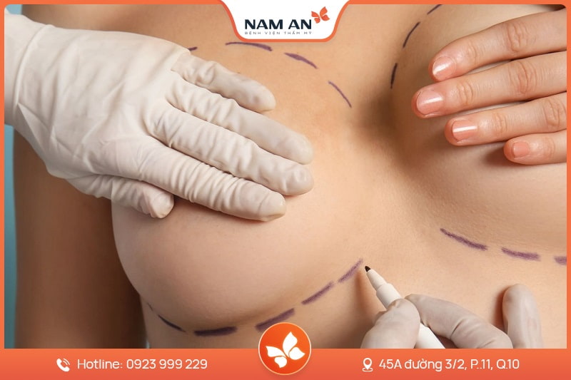 Nâng Ngực Bằng Mỡ Tự Thân Tự Nhiên Chuẩn Y Khoa Tại Nam An