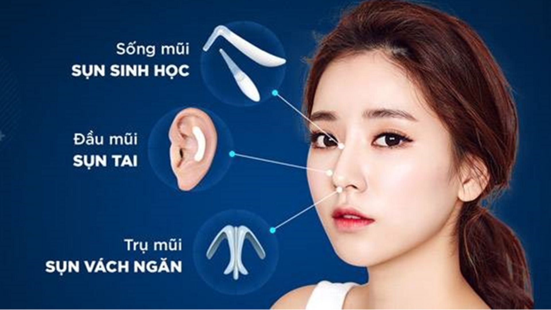 Nên Chọn Loại Sụn Nào Khi Nâng Mũi Tư Vấn Chuyên Sâu (1)