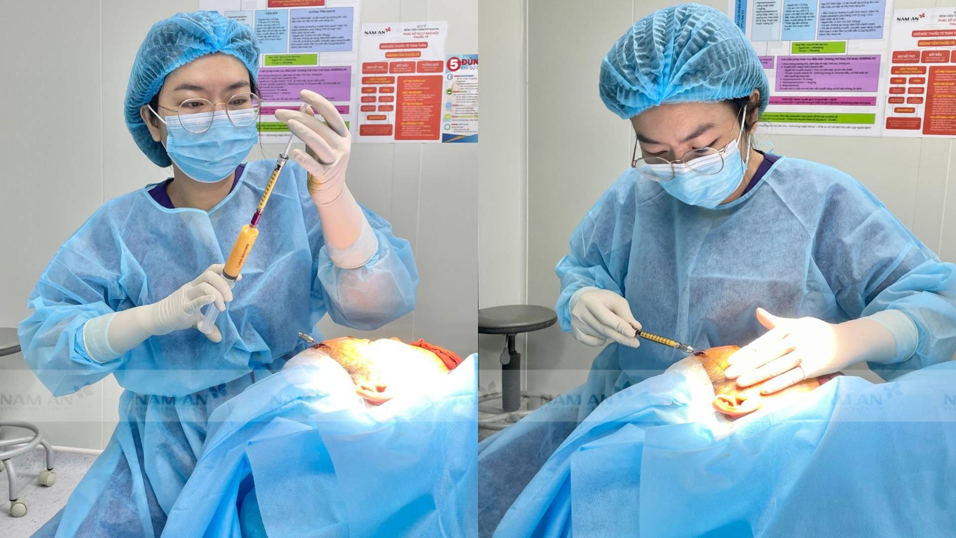 Những Lưu Ý Quan Trọng Khi Thực Hiện Cấy Mỡ Tự Thân (2)