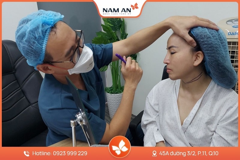 Phẫu Thuật Căng Da Cổ Xóa Nhăn, Nâng Cơ Tại BVTM Nam An (2)
