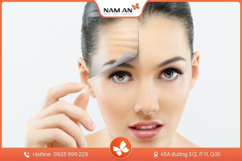 Phẫu Thuật Căng Da Trán Xóa Nhăn Hiệu Quả Tại Nam An (4)