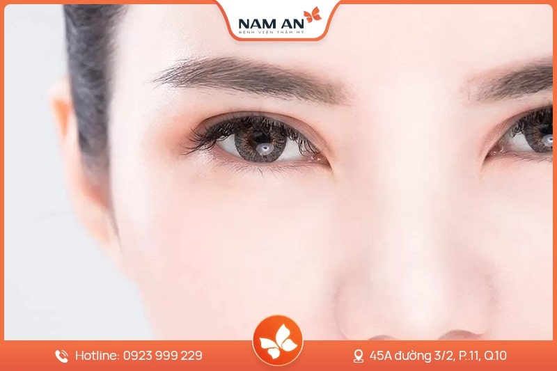 Phẫu Thuật Cắt Mắt 2 Mí Đẹp Tự Nhiên Tại BVTM Nam An (4)