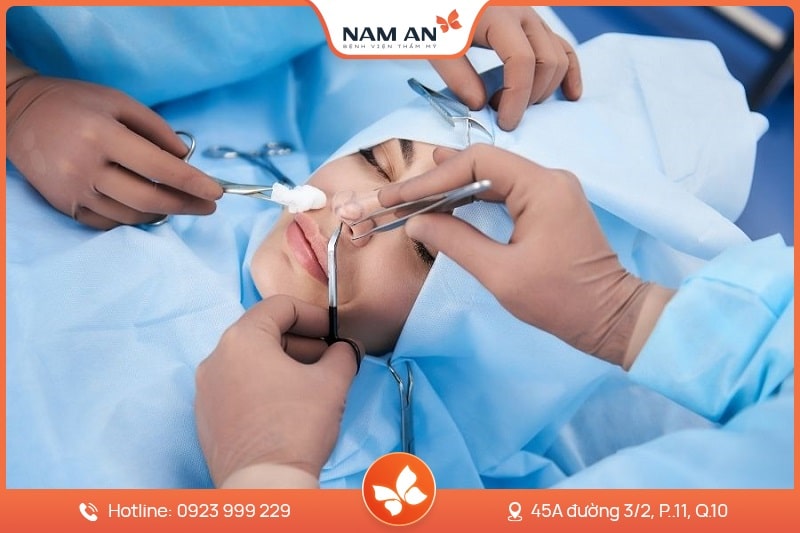 Phẫu Thuật Cuộn Cánh Mũi Thon Gọn Tại BVTM Nam An