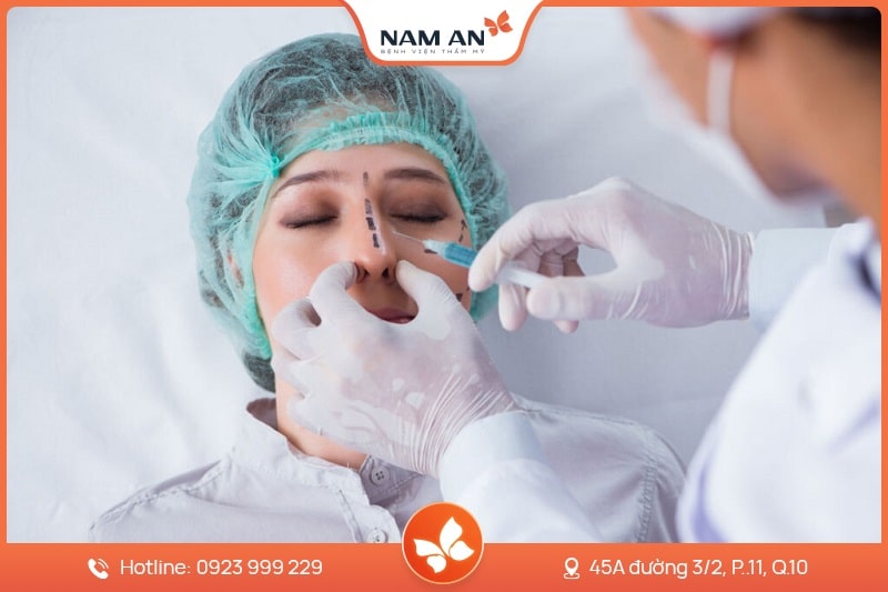 Phẫu Thuật Cuộn Cánh Mũi Thon Gọn Tại BVTM Nam An (3)