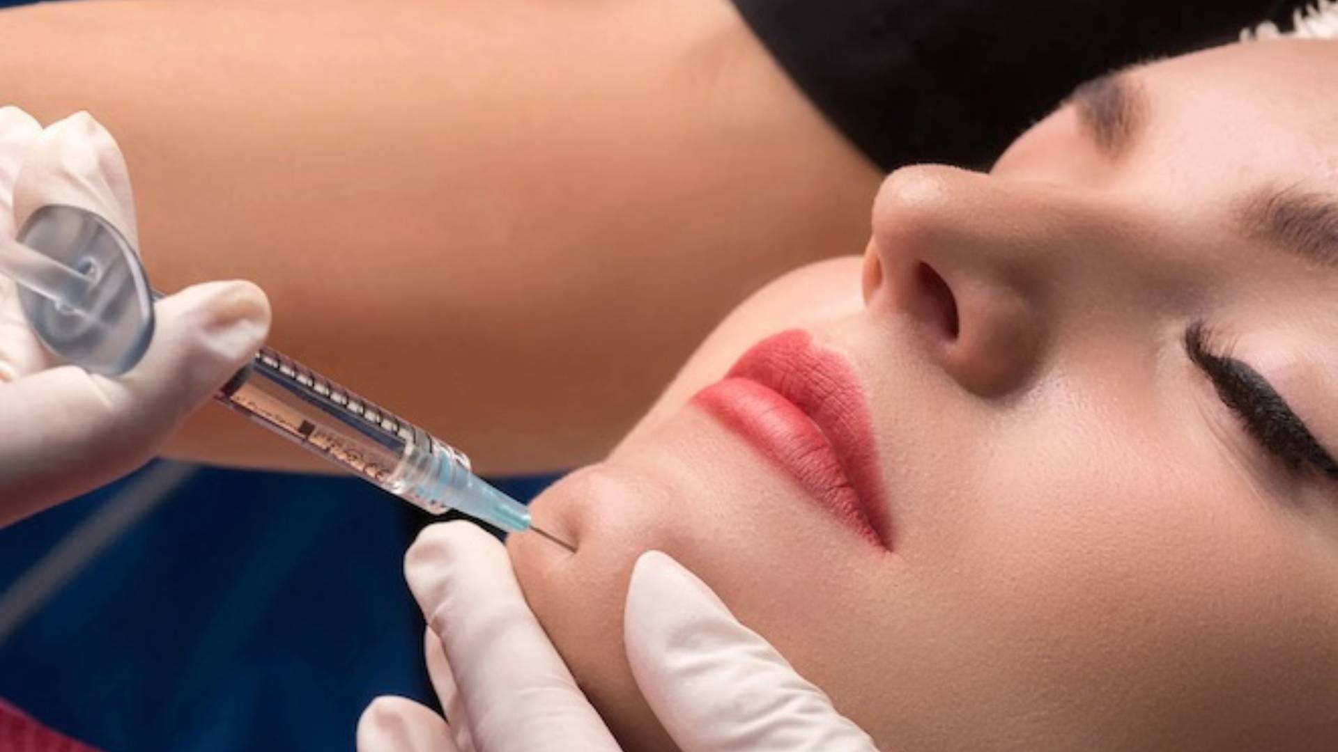 Phẫu Thuật Độn Cằm Duy Trì Được Bao Lâu Giải Đáp (4)