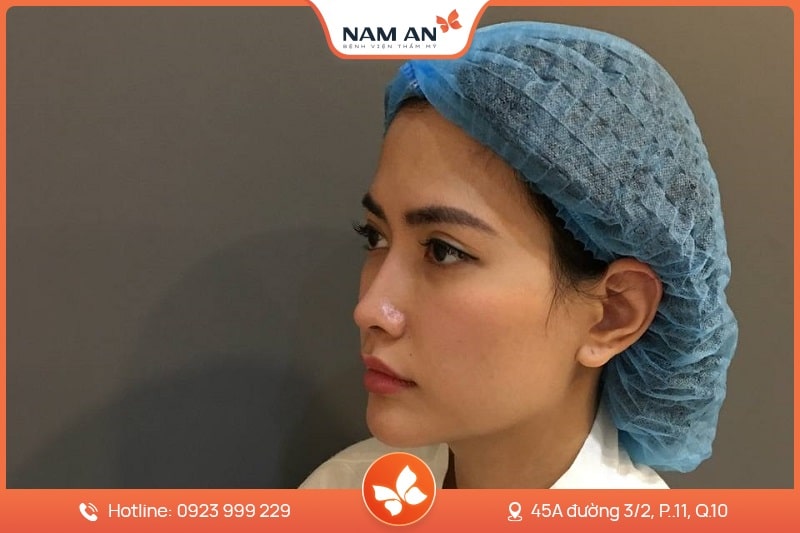 Phẫu Thuật ĐộPhẫu Thuật Độn Cằm V-Line Cân Đối Tại BVTM Nam An (6)n Cằm V-Line Cân Đối Tại BVTM Nam An (6)
