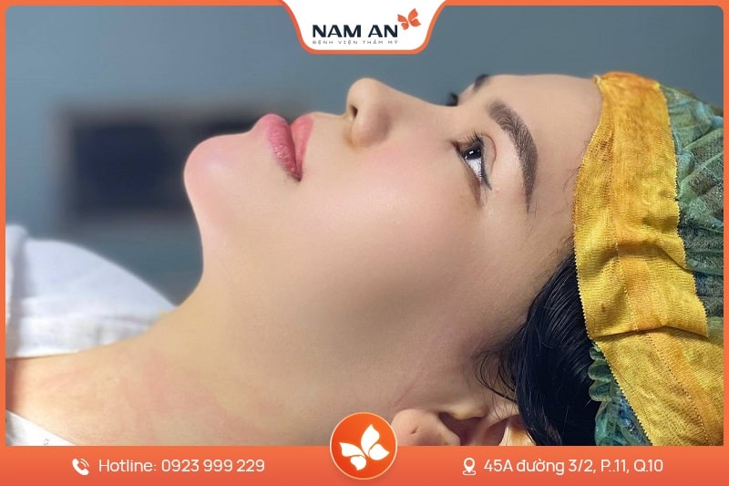 Phẫu Thuật Độn Cằm V-Line Cân Đối Tại BVTM Nam An (9)