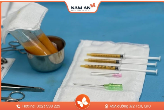Phẫu Thuật Độn Thái Dương Có Nguy Hiểm Không (5)
