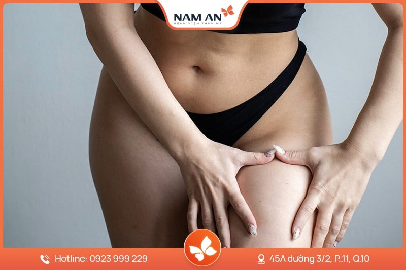 Phẫu Thuật Hút Mỡ Đùi Thon Gọn Tại Thẩm Mỹ Nam An (3)