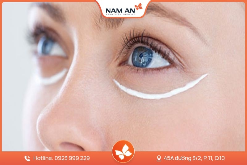 Phẫu Thuật Lấy Mỡ Mi Mắt Trẻ Hóa Đôi Mắt Tại Nam An (2)