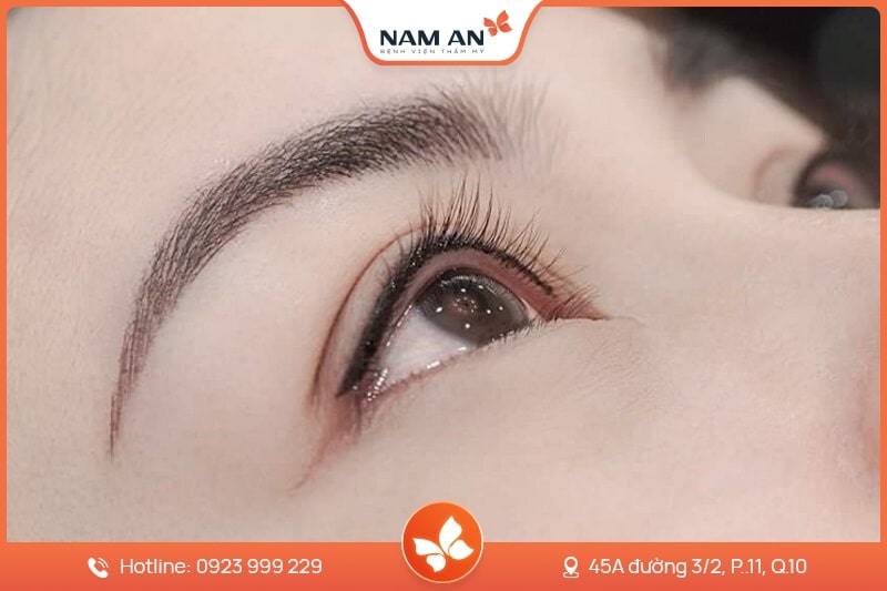 Phẫu Thuật Mở Góc Mắt Trong Và Ngoài Tại BVTM Nam An (4)