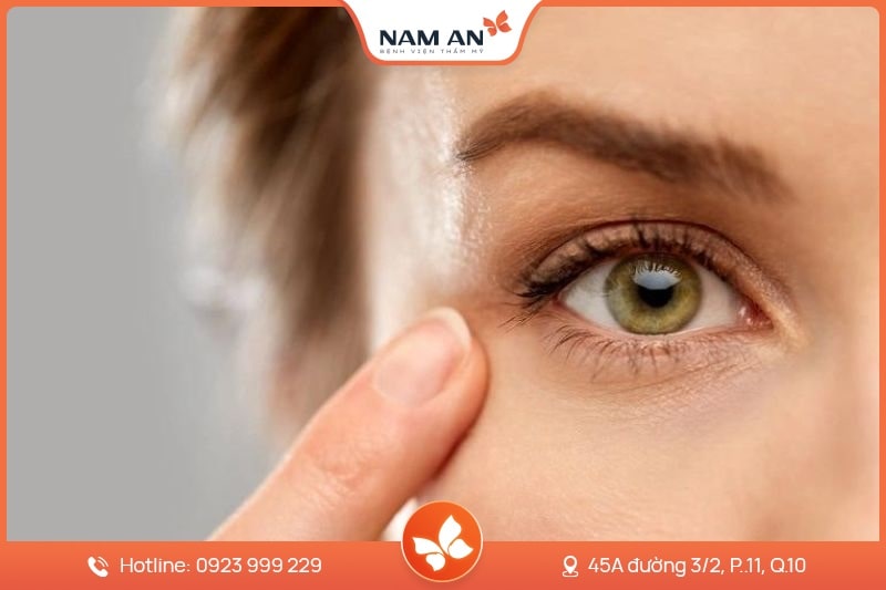 Phẫu Thuật Mở Góc Mắt Trong Và Ngoài Tại BVTM Nam An (8)