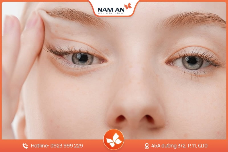 Phẫu Thuật Nâng Cung Chân Mày Trẻ Hóa Mắt Tại Nam An (3)