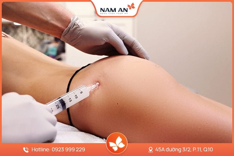 Phẫu Thuật Nâng Mông Nội Soi An Toàn Tại BVTM Nam An (6)