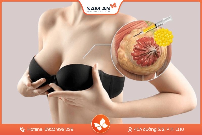 Phẫu Thuật Thu Nhỏ Ngực Quá Khổ - Bệnh Viện Nam An (3)
