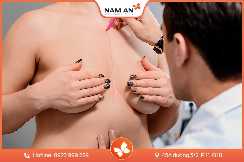 Phẫu Thuật Thu Nhỏ Ngực Quá Khổ - Bệnh Viện Nam An (5)