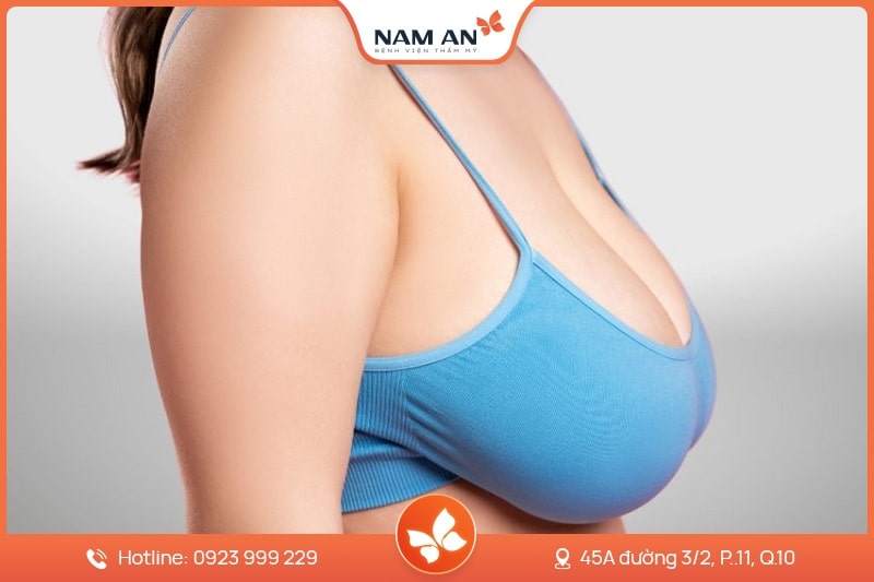 Phẫu Thuật Thu Nhỏ Ngực Quá Khổ - Bệnh Viện Nam An