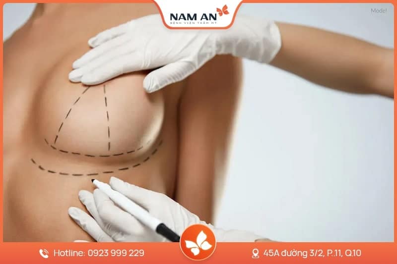 Phẫu Thuật Treo Ngực Sa Trễ - Lấy Lại Vòng 1 Săn Chắc
