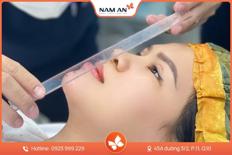 Phẫu Thuật Trượt Cằm Tự Thân Đẹp Tự Nhiên Tại Nam An (5)