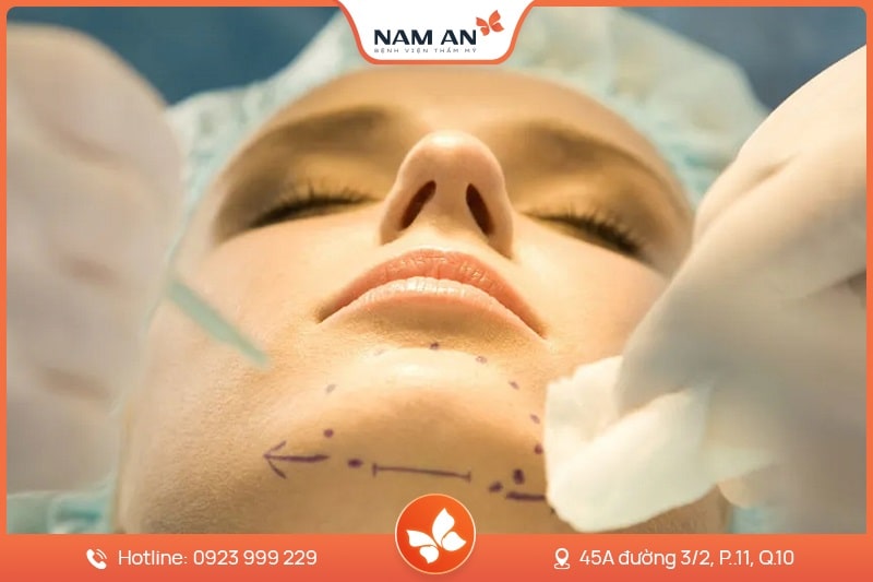 Phẫu Thuật Trượt Cằm Tự Thân Đẹp Tự Nhiên Tại Nam An (6)