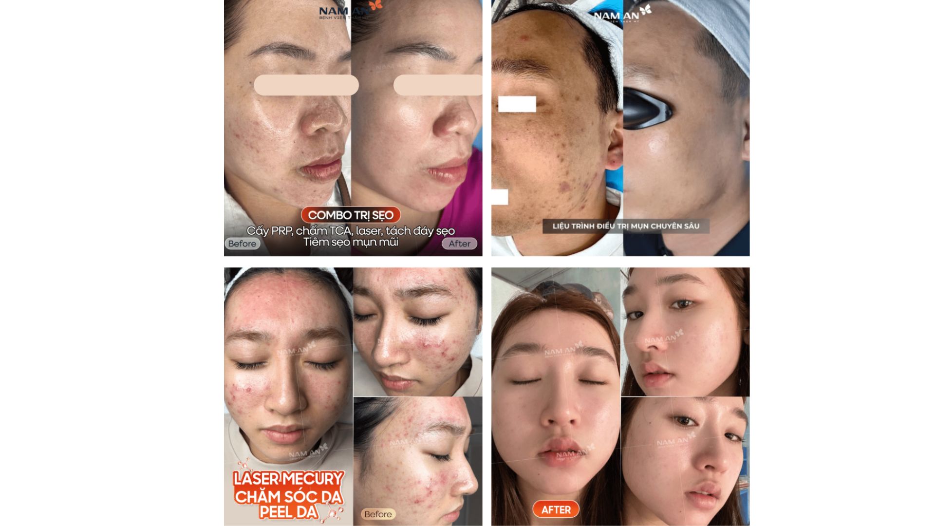 Phương Pháp Trẻ Hóa Không Phẫu Thuật Tại Nam An (2)