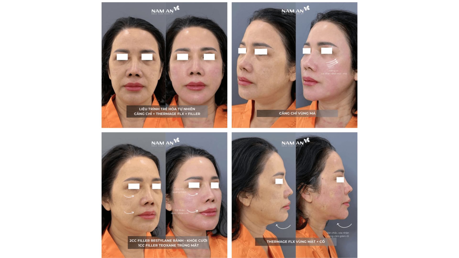 Phương Pháp Trẻ Hóa Không Phẫu Thuật Tại Nam An (8)