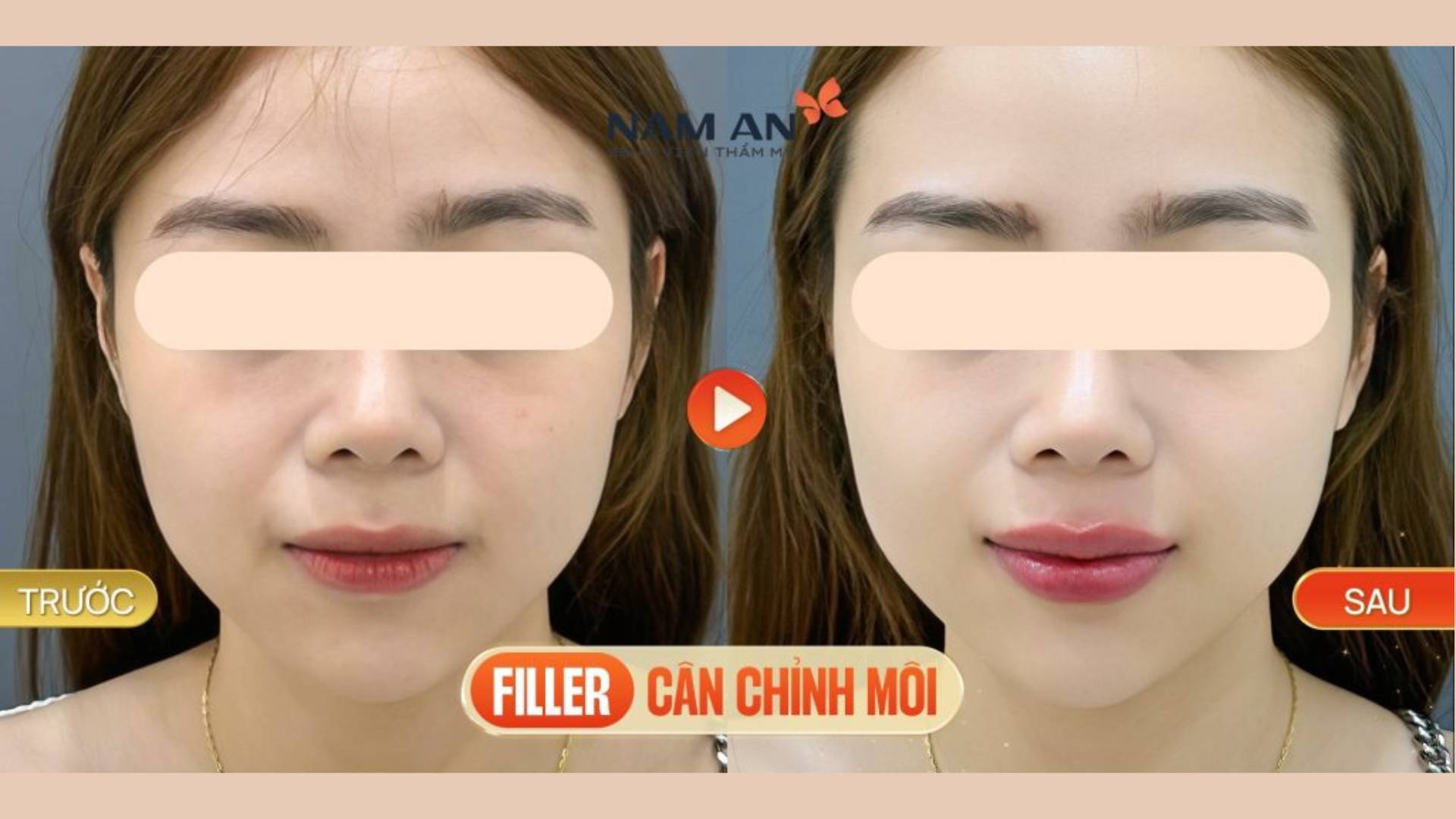 Top 5 Dịch Vụ Chăm Sóc Da Đón Tết Rạng Rỡ Tại Nam An (4)