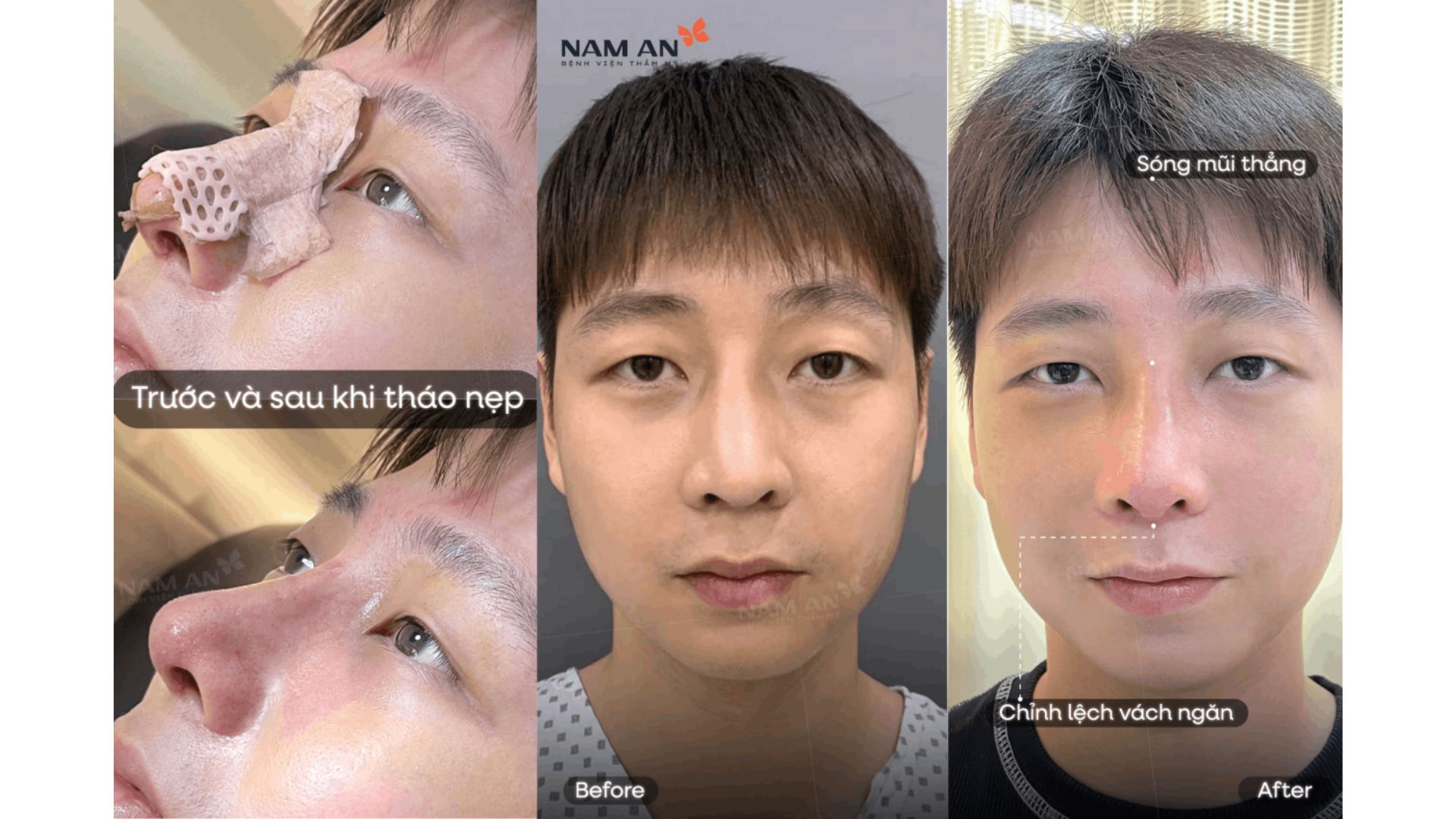 Top Dịch Vụ Được Yêu Thích Nhất Tại BVTM Nam An (1)