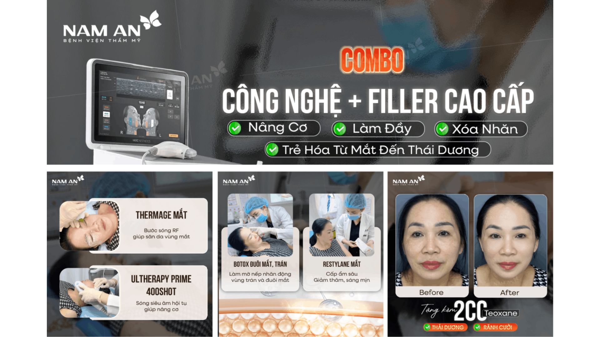 Top Dịch Vụ Được Yêu Thích Nhất Tại BVTM Nam An (5)