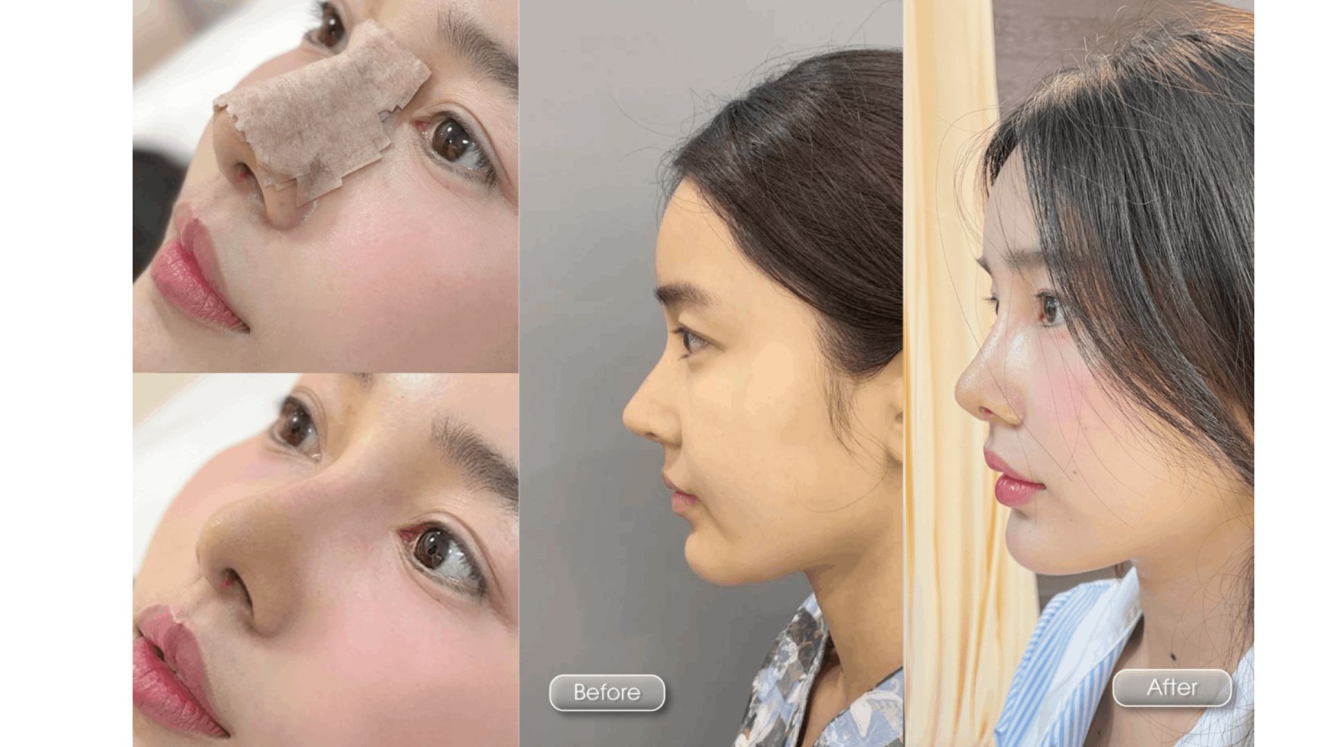 Top Dịch Vụ Được Yêu Thích Nhất Tại BVTM Nam An (7)