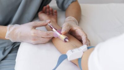 Trẻ Hóa Da Tự Thân Bằng Công Nghệ PRP/PRF Tại Nam An