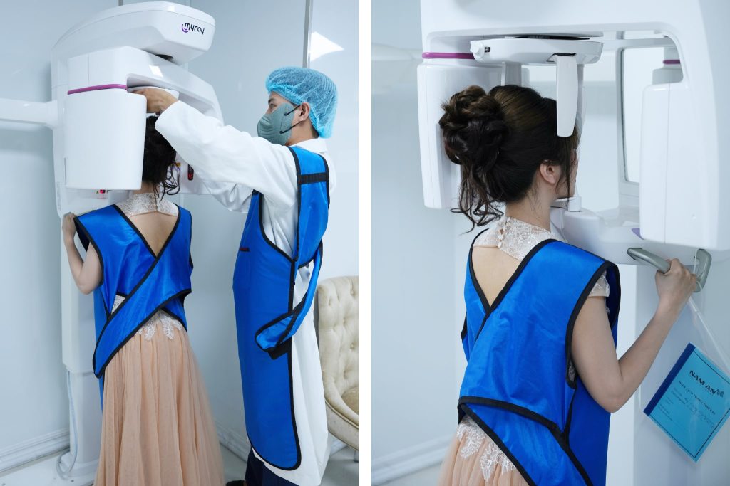 Trồng Răng Implant Mất Bao Lâu Yếu Tố Ảnh Hưởng (2)