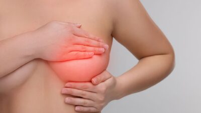 Ngực mềm bất thường có phải là nhão không?